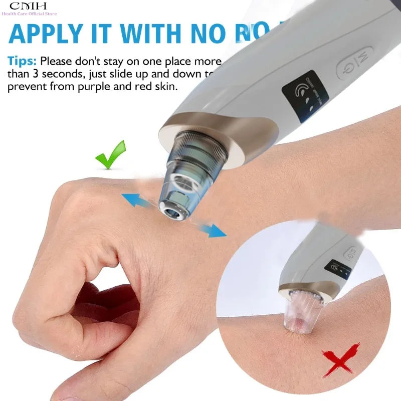 CMH Blackhead Remover Vacuum Pore Cleaner Multi Suction Heads Adjustable Suction USB Rechargeable Deep Cleansing Skin Tool Gifts
