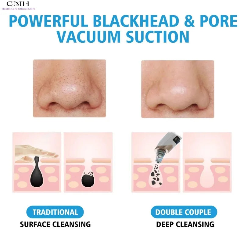 CMH Blackhead Remover Vacuum Pore Cleaner Multi Suction Heads Adjustable Suction USB Rechargeable Deep Cleansing Skin Tool Gifts