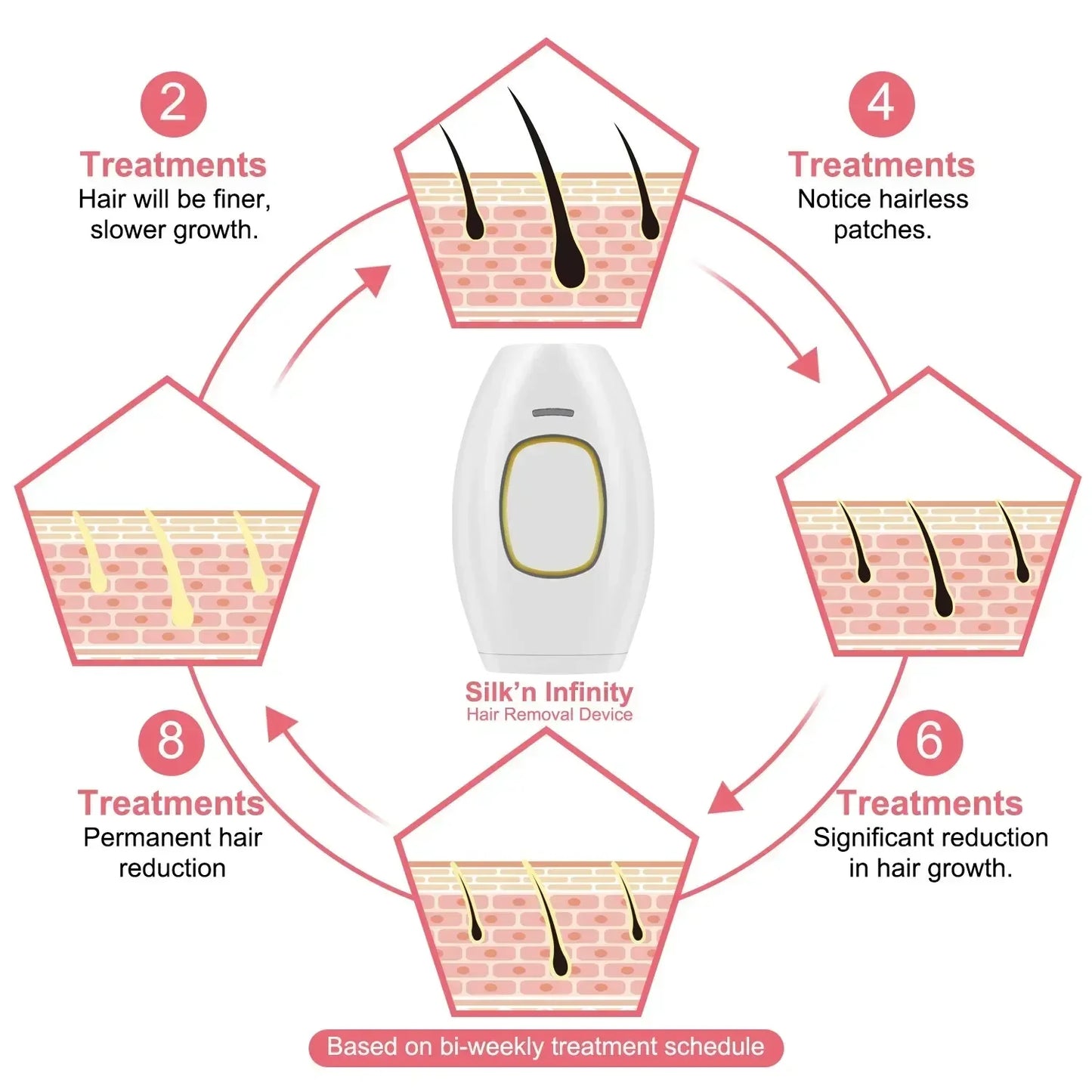 IPL Hair Removal Device for Women Painless Permanent Full Body Facial Upper Lip Bikini Legs Arms Face Women's Shaver Care Device
