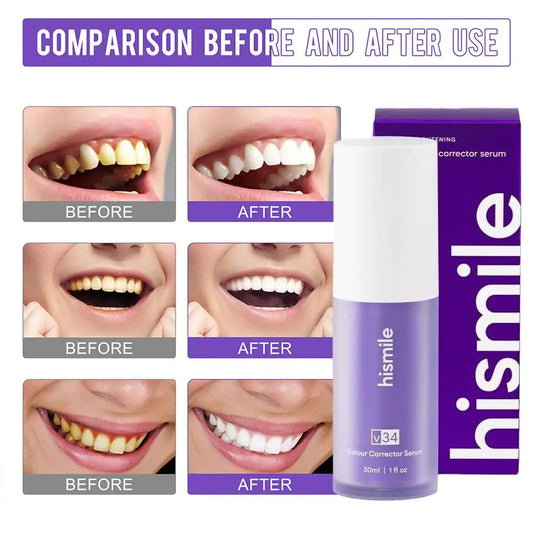 30ml Hismile V34 Purple Teeth Whitening Foam Press Type Color Correction Serum Sensitive Teeth Friendly
